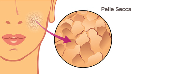 pelle secca